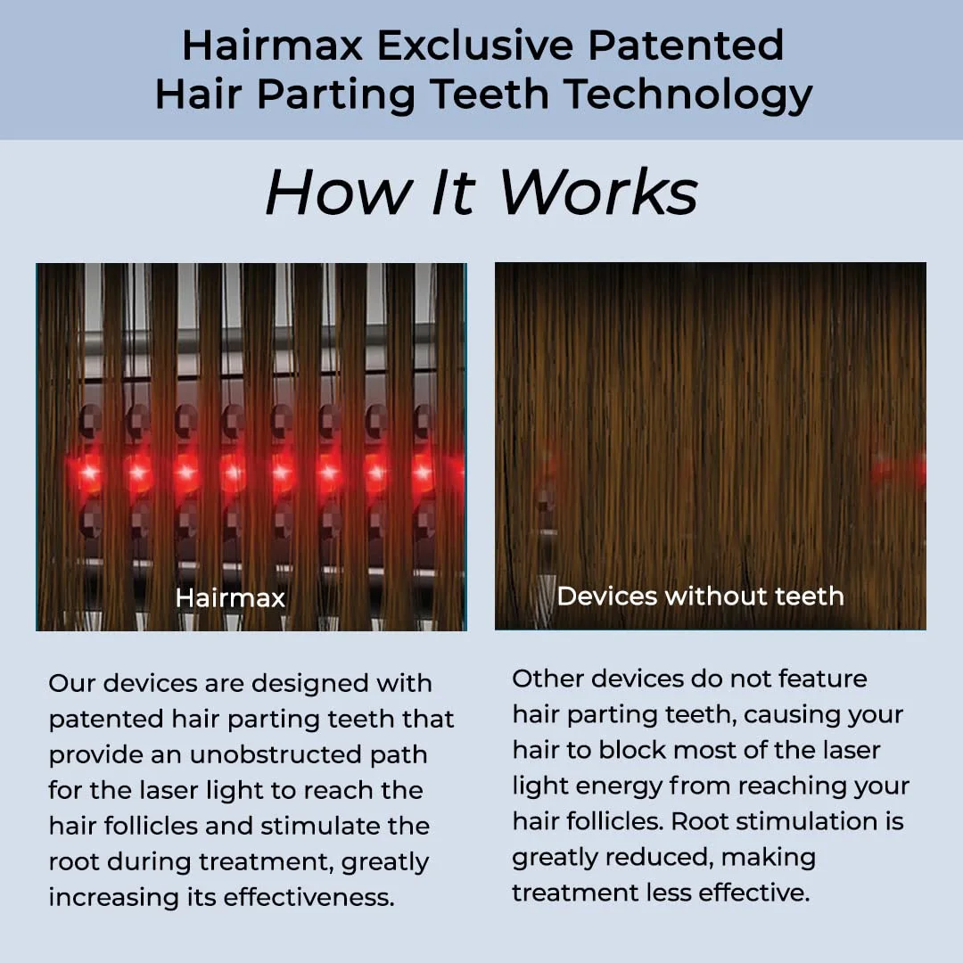 Hairmax Laser Band 41 - (FDA Cleared) Hair Growth Device - Laser Red Light Therapy to Hair Grow - Image 2